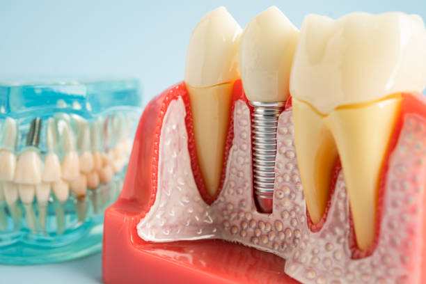 Professional  Dental Services in Roseland, FL